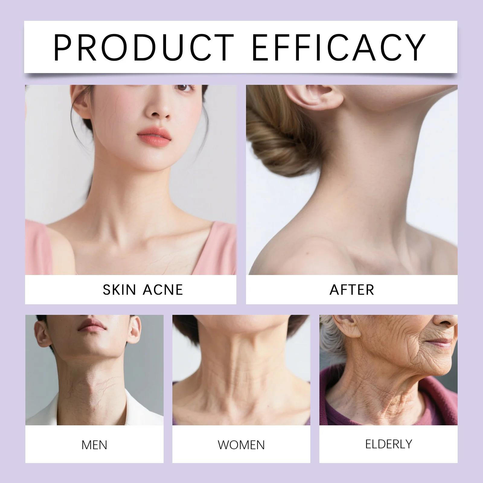 Hoygi Advanced Neck Cream with 4% Cupuacu Butter & Argireline for Firming, Smoothing Fine Lines 9 advanced neck firming cream hoy kgf9gjn4 desc 9