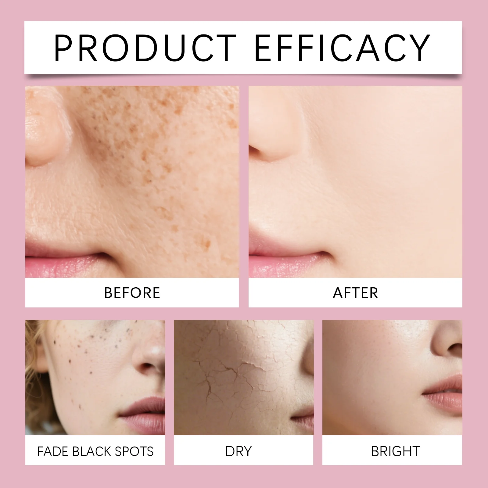 Brightening Cream for Face and Body with Retinol & Vitamin E, Fades Dark Spots, Hydrates Skin, 57g 9 brightening cream retinol vitamin e fades dark spots 57g hoy arpydndr desc 9