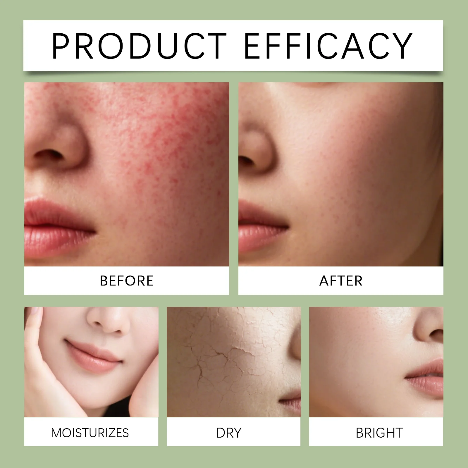Centella Asiatica Serum for Redness Relief & Moisturizing, 30ml 9 centella asiatica redness relief serum 30ml hoy 4psy72yz desc 9