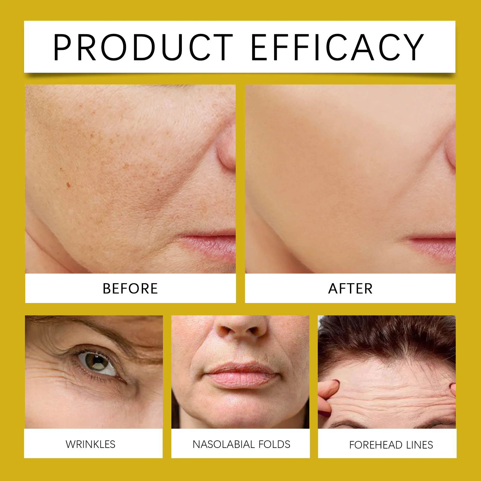 Bee Venom Firming Cream 50g Hydrating Moisturizer for Youthful Skin 9 hoygi bee venom firming cream 50g hoy ebebcy2x desc 9