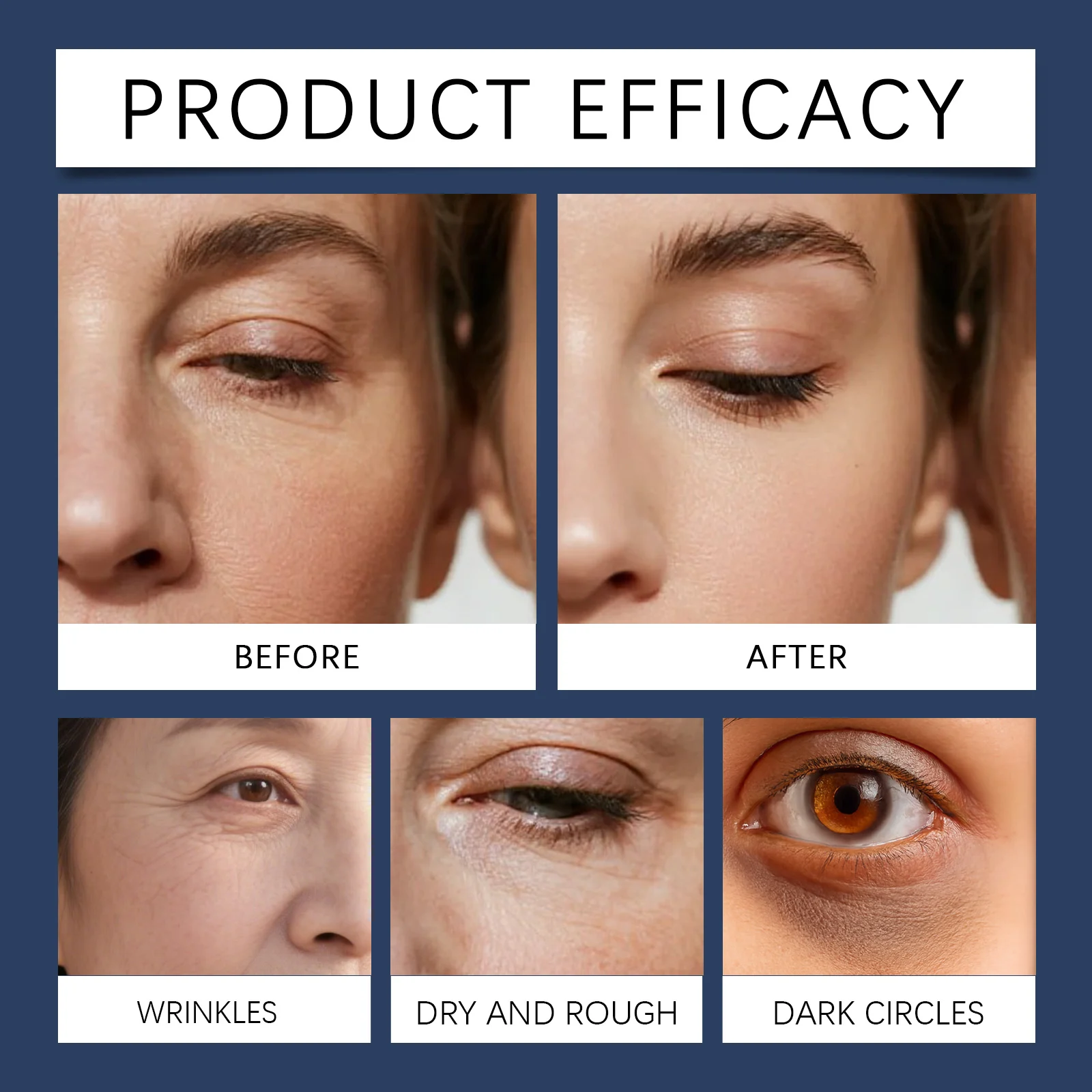 Eye Cream for Wrinkles and Hydration 15g Anti-Aging & Firming Eye Lifting Cream 9 hoygi eye lifting cream 15g hoy ryfzp9ak desc 9