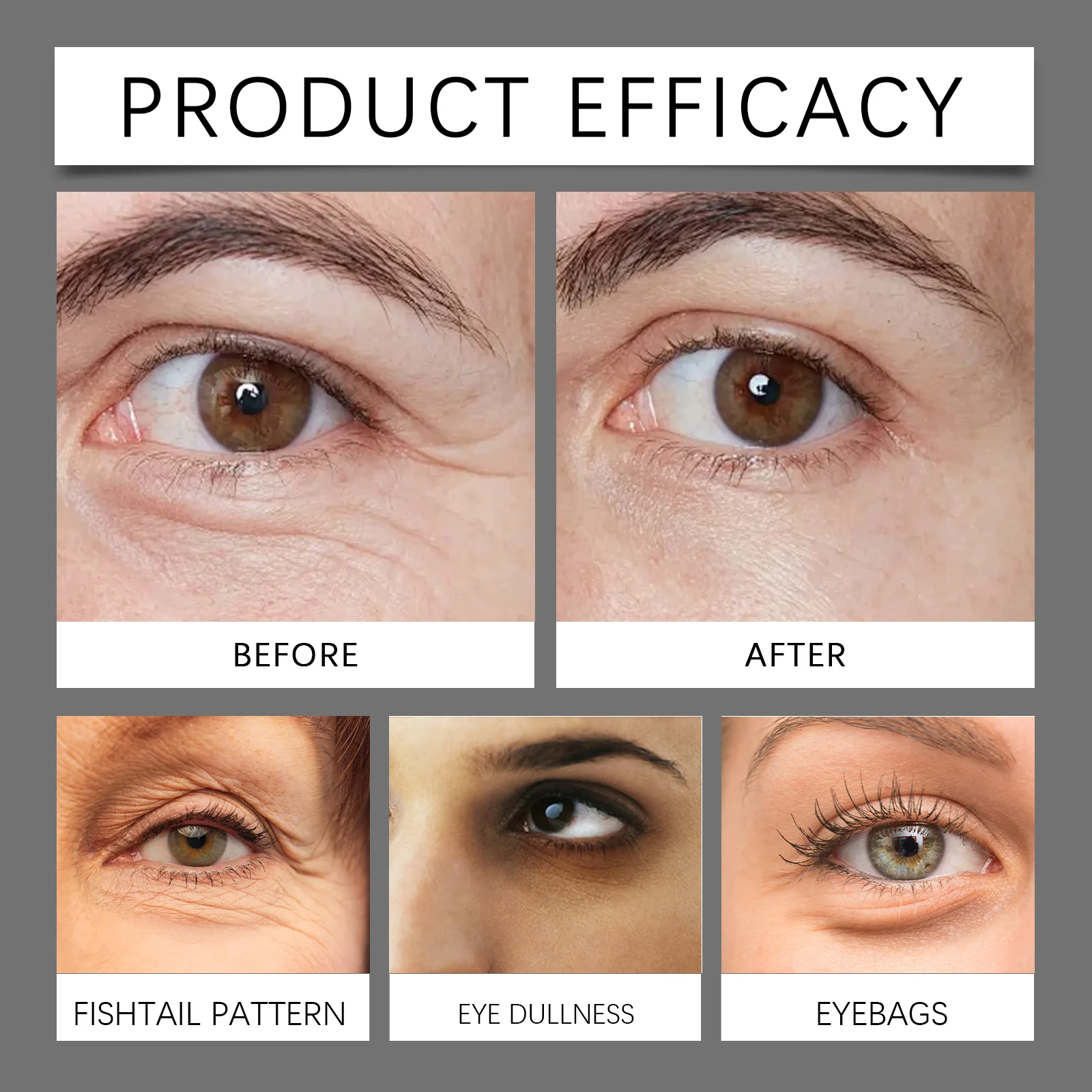 Retinol Eye Cream 20g for Dark Circles, Puffiness & Fine Lines 12 retinol eye cream 20g dark circles puffiness fine lines hoy e5ad3vca desc 12