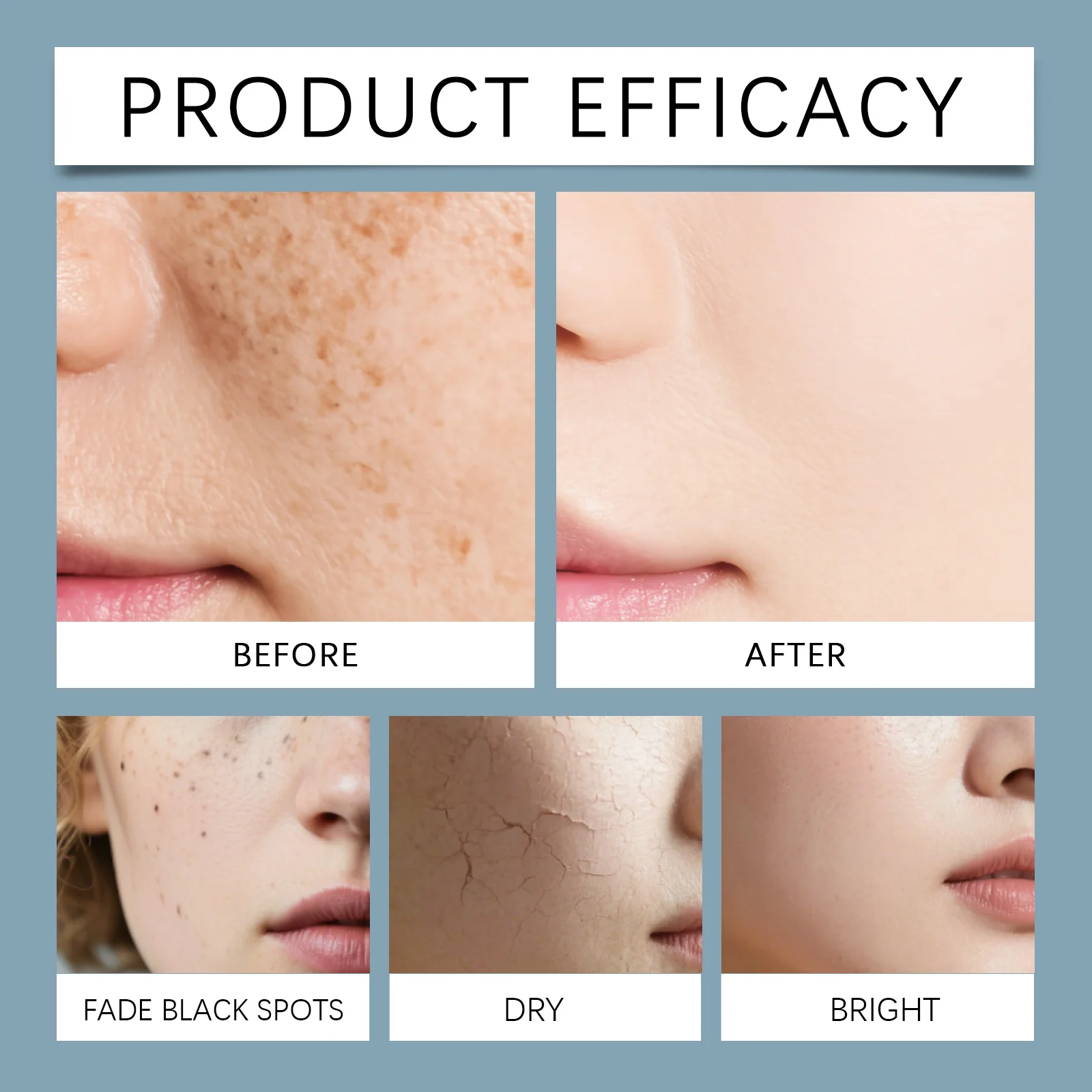 Tranexamic Acid Niacinamide Cream 50g Brightening Moisturizing Face Cream for Sun Damage & Dark Spot Reduction 12 tranexamic acid niacinamide cream 50g hoy wwx4nvx5 desc 12