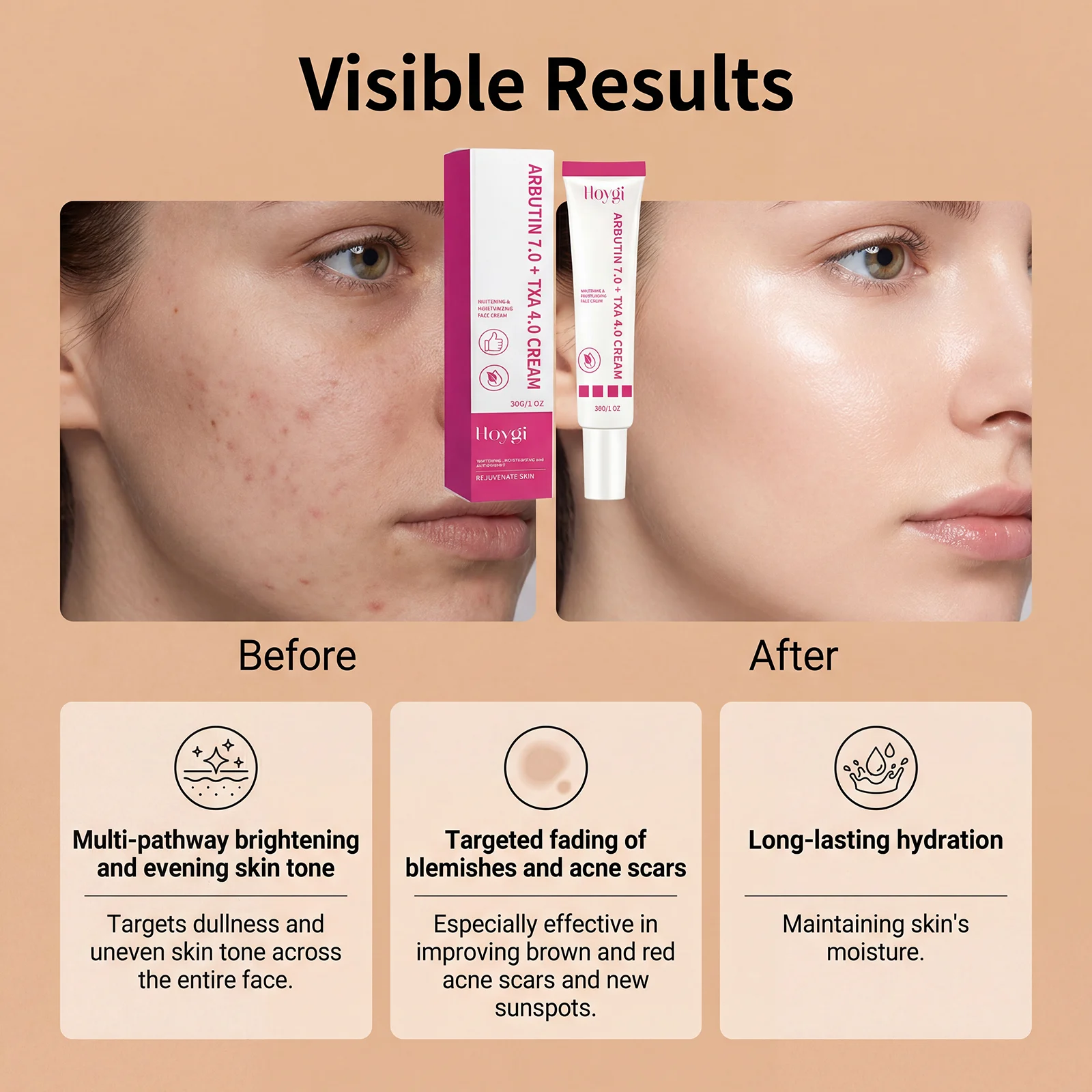 Whitening Moisturizing Face Cream with Arbutin & Tranexamic Acid 30g 9 whitening moisturizing face cream 30g hoy apd52n8k desc 9